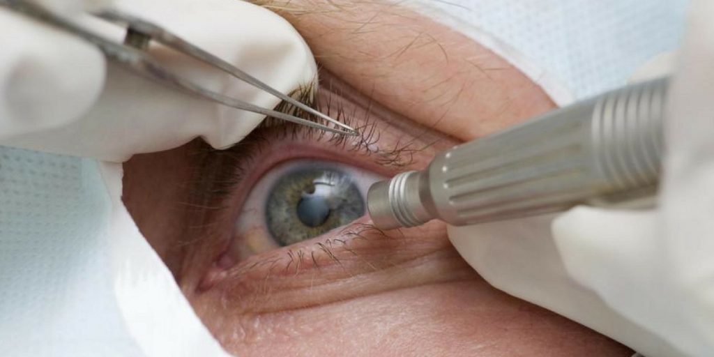Regular doctor visits can rule out the risk of developing glaucoma