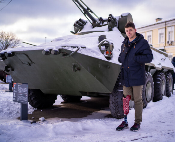 Turning point: Max Alekseev stepped on a mine during the war in eastern Ukraine and lost his right leg.  Despite the serious injury, he learned to walk again with a prosthesis.  Photo: Aage Aune / TV 2