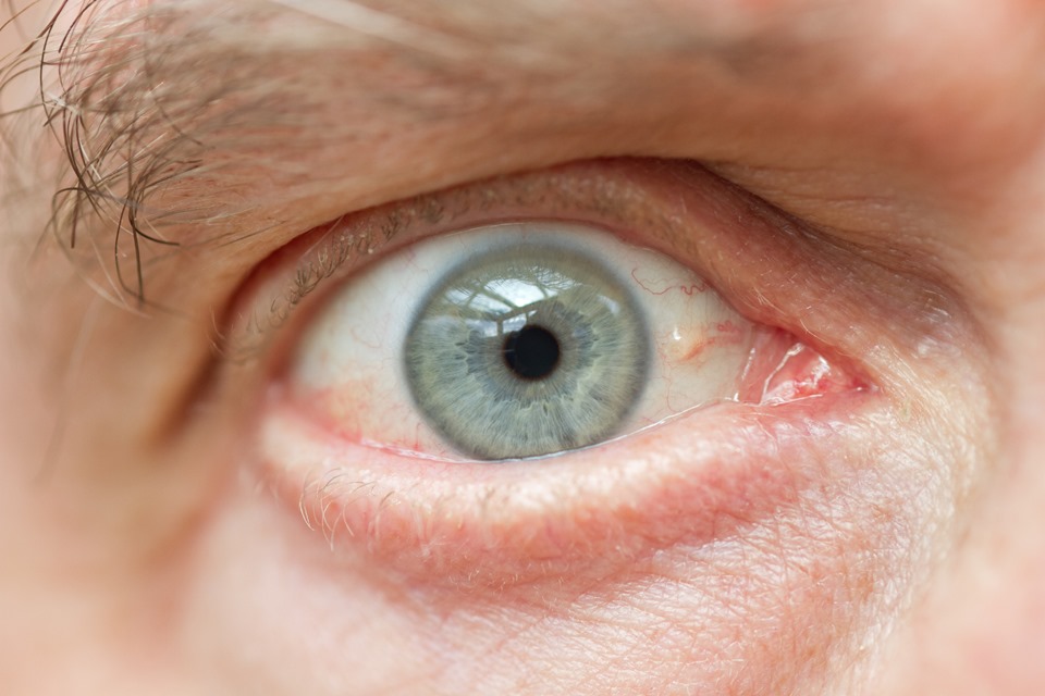 Study suggests eye age may indicate risk of early death