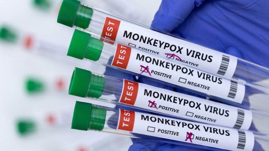Monkeypox: 'Don't panic'