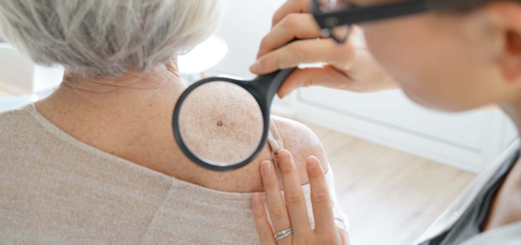 An oncologist lists 7 signs on the body that could indicate cancer