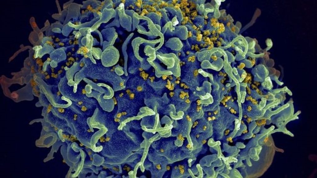 HIV: Doctors announce the fourth case of recovery |  health