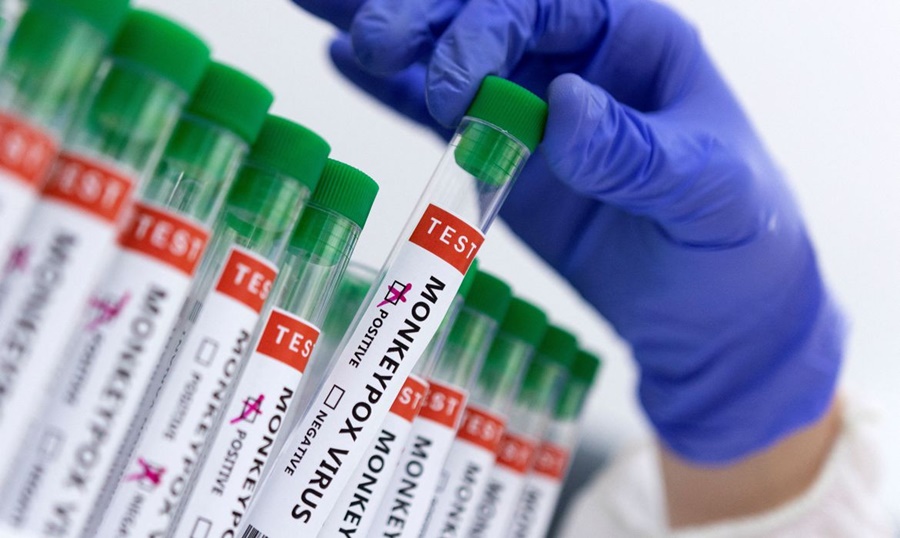 Imagem: TSTE VARIOLA Ministério da Ciência investe R$ 3 milhões em pesquisas sobre varíola dos macacos