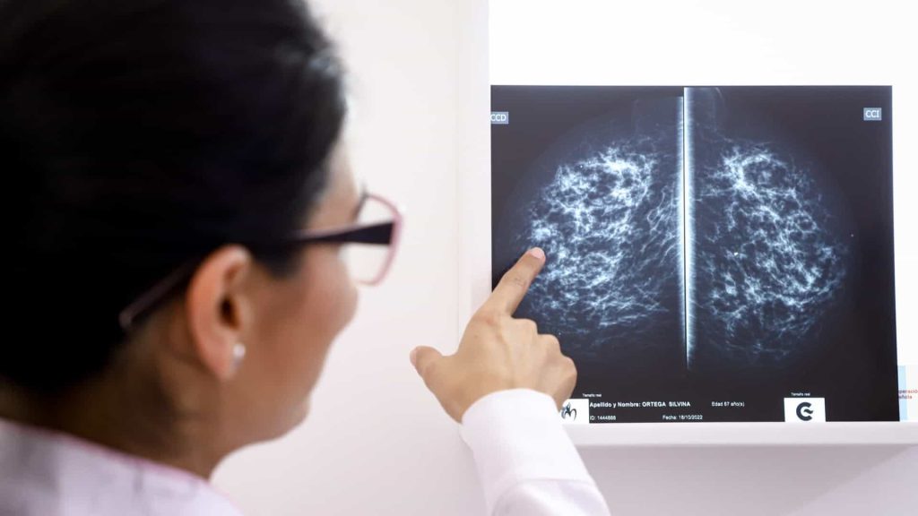 Low-income women participate less in cancer screening
