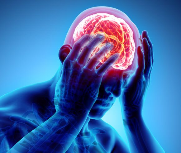 Primary pain: According to Lommelegen, migraine attacks can last anywhere from 4 to 72 hours if not treated with medication.  Image: shutterstock